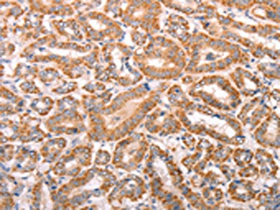 TRPV4 Antibody