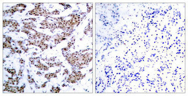 Phospho-MEF2A (Thr312) Antibody