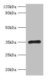 RPL5 Antibody