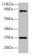 RPL17 Antibody