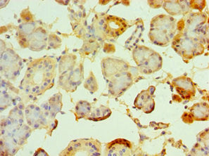 TRPM2 Antibody