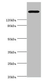 TRPM2 Antibody
