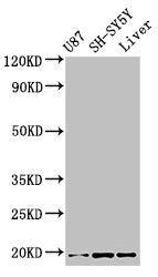 TSLP Antibody