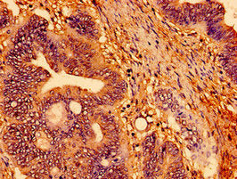 TSPO Antibody