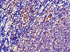 TTK Antibody