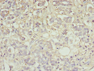 Ttr Antibody