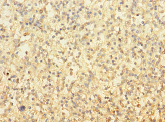 TUBAL3 Antibody