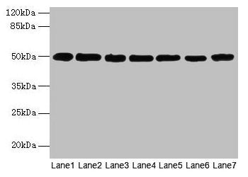 TUBB Antibody