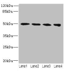TUBB2A Antibody