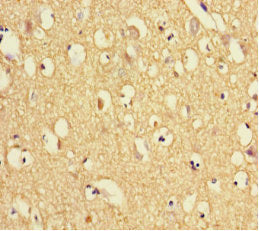 TXNDC9 Antibody