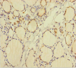 TXNL1 Antibody