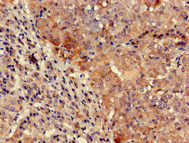 TYK2 Antibody