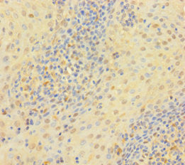 TYMP Antibody