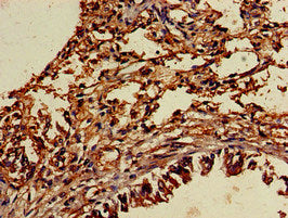 TYRO3 Antibody