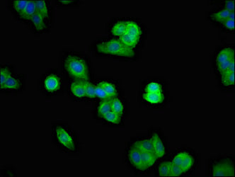 UBASH3A Antibody