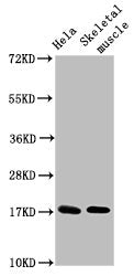 UBE2D3 Antibody