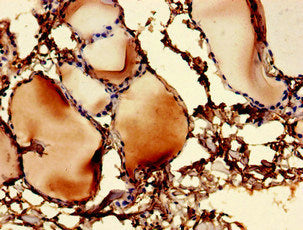 UBE2V1 Antibody