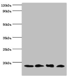 UBE2V2 Antibody