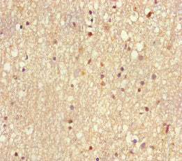 UBE2V2 Antibody