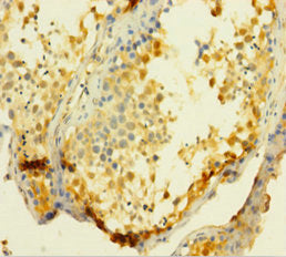 UCK1 Antibody