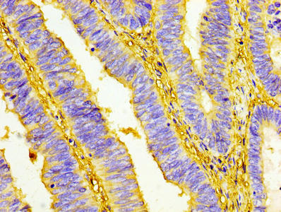 UCP1 Antibody
