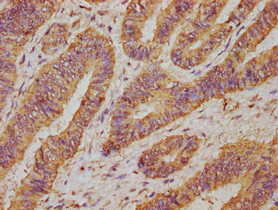 UCP2 Antibody