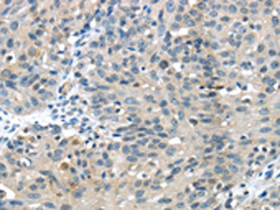 GLP2R Antibody