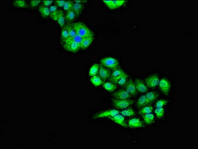 ULK1 Antibody