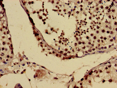 USO1 Antibody