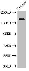 USP6 Antibody