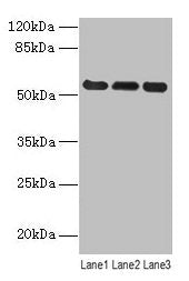 VIM Antibody