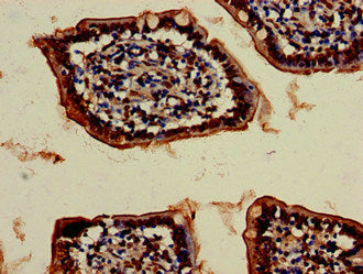VPS4B Antibody