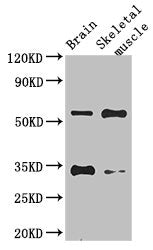 VTN Antibody