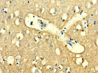 WDR27 Antibody