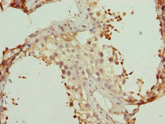WDR47 Antibody