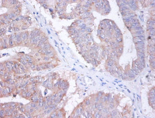 AP2S1 Antibody