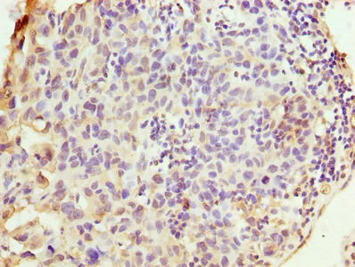 WDR62 Antibody