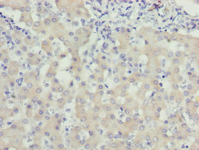 WDR91 Antibody