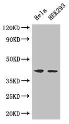 ACTG1 Antibody
