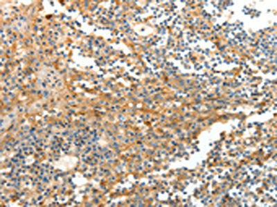 DTX3 Antibody
