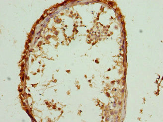 M6PR Antibody