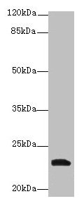 YKT6 Antibody