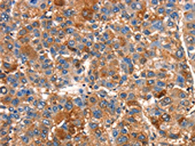 SMURF1 Antibody