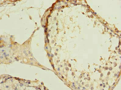 ZBTB43 Antibody