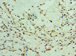 ZEB2 Antibody