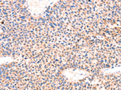 AMPD1 Antibody