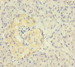 ZNF114 Antibody
