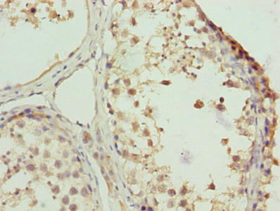 ZNF131 Antibody