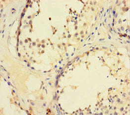 ZNF165 Antibody