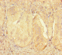 ZNF175 Antibody